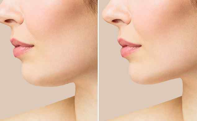 https://prova5.demo.servonet.it/wp-content/uploads/2026/05/image_before_after_02.jpg