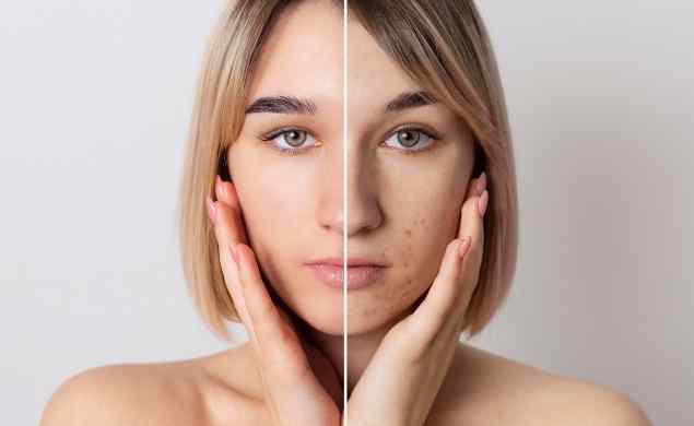https://prova5.demo.servonet.it/wp-content/uploads/2026/05/image_before_after_04.jpg